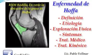 RM de rodilla que muestra la grasa de Hoffa en verde. Enfermedad de Hoffa: definición, etiología, exploración, síntomas y tratamiento.