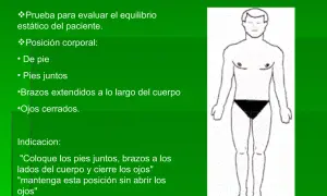 Ilustración de la prueba Romberg: paciente de pie, pies juntos, brazos a los lados y ojos cerrados para evaluar equilibrio.