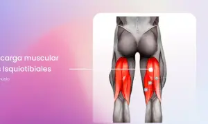Anatomía de la pierna mostrando la sobrecarga muscular de los isquiotibiales, con los músculos resaltados en rojo.
