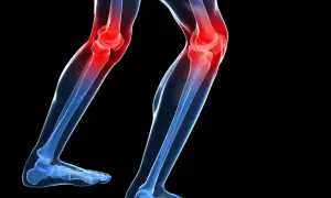 Ilustración de unas piernas con las rodillas en rojo, indicando dolor. De repente me falla la rodilla al caminar.