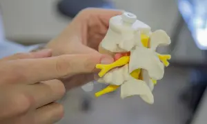 Modelo de vértebras y nervios, mostrando la distribución de los dermatomas cervicales.