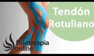 Pierna con vendaje de kinesiotaping para tendinitis rotuliana. Fisioterapia online.