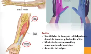 Ilustración del brazo y mano mostrando el nervio cubital y su trayecto. El test nervio radial evalúa la sensibilidad y movimientos.