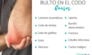 Un codo con un bulto rojo e inflamado. La imagen lista posibles causas de un bulto en el codo, como lipoma, bursitis o fractura.