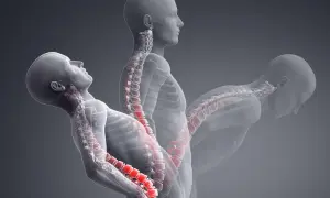Ilustración de la columna vertebral humana en tres posturas, mostrando la tensión en las articulaciones interapofisarias.