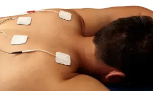 Electrodos colocados en la espalda de un hombre para tratamiento de electroterapia en fisioterapia.