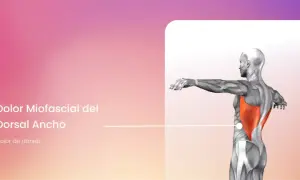 Anatomía del dolor miofascial en el dorsal ancho, mostrando el músculo resaltado en rojo.