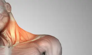 Anatomía del cuello con los escalenos musculos resaltados en rojo, indicando posible tensión o dolor.