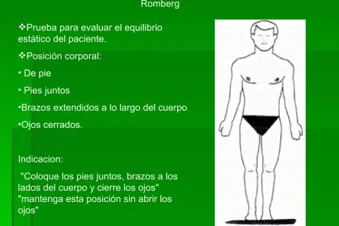 Ilustración de la prueba Romberg: paciente de pie, pies juntos, brazos a los lados y ojos cerrados para evaluar equilibrio.