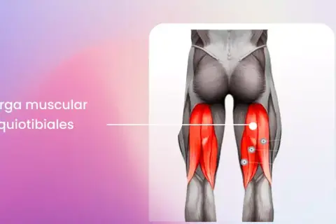 Anatomía de la pierna mostrando la sobrecarga muscular de los isquiotibiales, con los músculos resaltados en rojo.