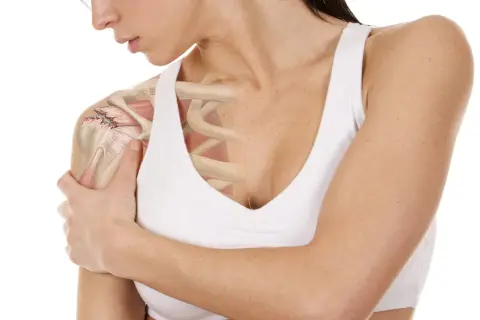 Anatomía del hombro con detalle de desgarro en el manguito rotador, mostrando el dolor y la inflamación.