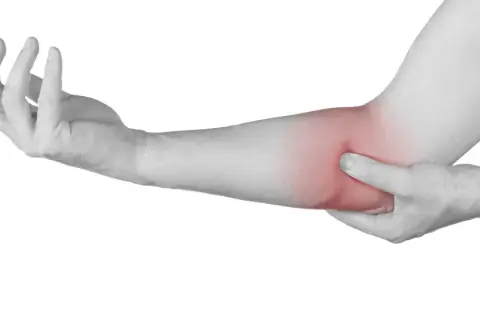 Brazo con zona enrojecida en el codo, indicando posible irritación del nervio cubital.
