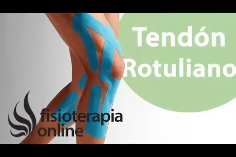 Pierna con vendaje de kinesiotaping para tendinitis rotuliana. Fisioterapia online.