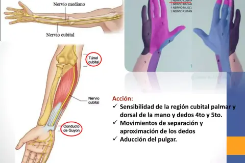 Ilustración del brazo y mano mostrando el nervio cubital y su trayecto. El test nervio radial evalúa la sensibilidad y movimientos.
