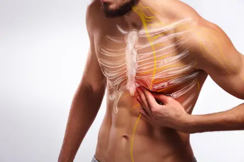 Hombre con dolor en el pecho, señalando una posible contractura intercostal. Se visualizan costillas y nervios.