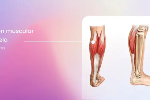 Ilustración anatómica de la pantorrilla, mostrando la distensión muscular del gemelo y el dolor asociado en la pierna.