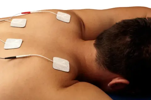 Electrodos colocados en la espalda de un hombre para tratamiento de electroterapia en fisioterapia.