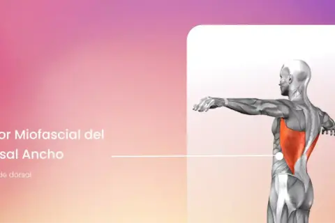 Anatomía del dolor miofascial en el dorsal ancho, mostrando el músculo resaltado en rojo.