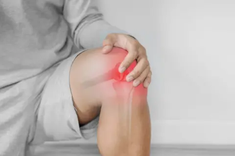 Hombre tocando su rodilla con un área roja brillante que indica dolor y sensación de quemazón.
