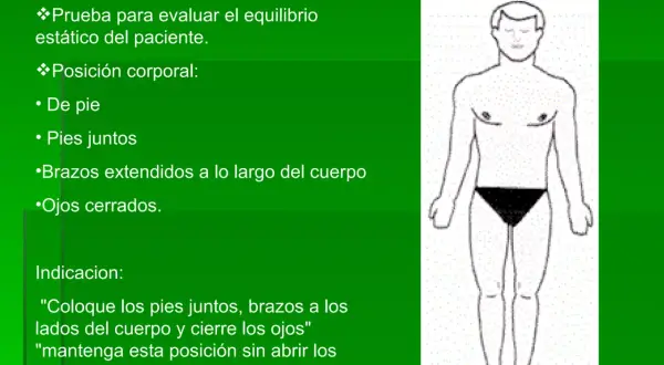 Ilustración de la prueba Romberg: paciente de pie, pies juntos, brazos a los lados y ojos cerrados para evaluar equilibrio.
