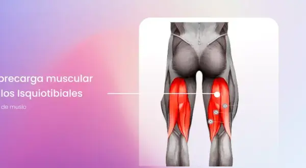 Anatomía de la pierna mostrando la sobrecarga muscular de los isquiotibiales, con los músculos resaltados en rojo.
