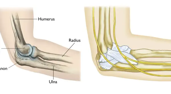 Ilustración anatómica del codo, mostrando el húmero, radio, cúbito y olecranon. La imagen de la derecha detalla nervios y ligamentos, útil para entender una fractura olecranon.