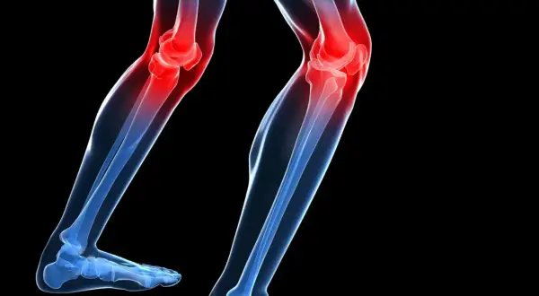 Ilustración de unas piernas con las rodillas en rojo, indicando dolor. De repente me falla la rodilla al caminar.