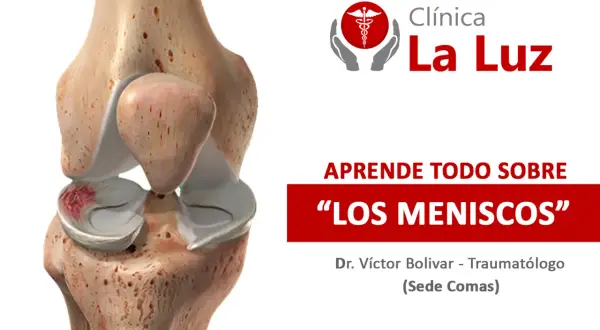 Anatomía de la rodilla mostrando cuántos meniscos tiene la rodilla, con información de la Clínica La Luz.