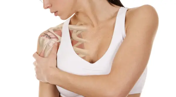 Anatomía del hombro con detalle de desgarro en el manguito rotador, mostrando el dolor y la inflamación.