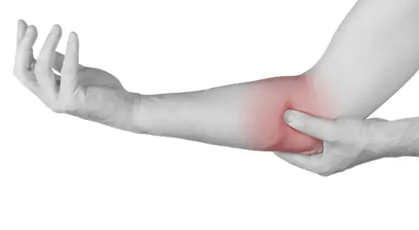 Brazo con zona enrojecida en el codo, indicando posible irritación del nervio cubital.