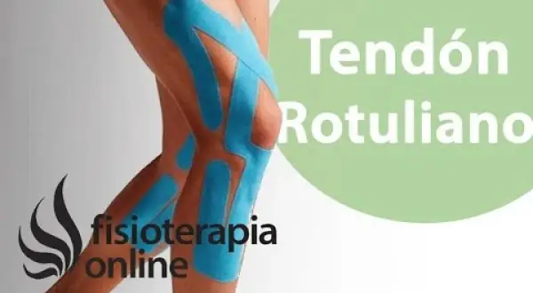 Pierna con vendaje de kinesiotaping para tendinitis rotuliana. Fisioterapia online.