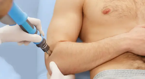 Tratamiento de epicondilitis con magnetoterapia. Un profesional aplica un dispositivo en el codo de un paciente.
