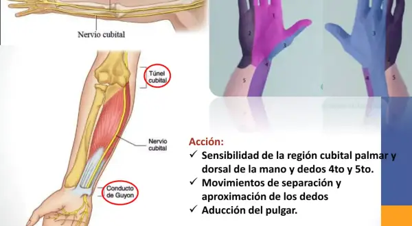 Ilustración del brazo y mano mostrando el nervio cubital y su trayecto. El test nervio radial evalúa la sensibilidad y movimientos.