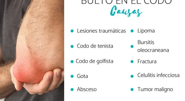 Un codo con un bulto rojo e inflamado. La imagen lista posibles causas de un bulto en el codo, como lipoma, bursitis o fractura.