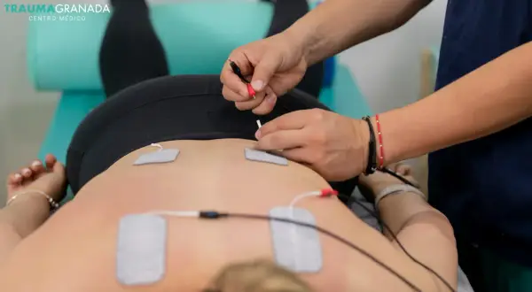 Fisioterapeuta aplica electroestimulación en la espalda de un paciente. Un tratamiento para aliviar el dolor y mejorar la recuperación muscular.