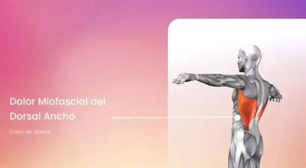 Anatomía del dolor miofascial en el dorsal ancho, mostrando el músculo resaltado en rojo.