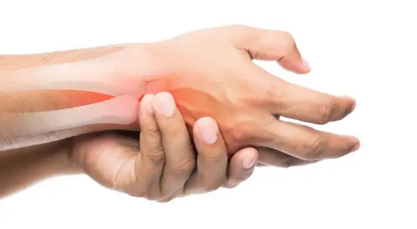 Mano con hueso resaltado en rojo, indicando posible fractura de dedo. El tiempo de recuperación es clave.