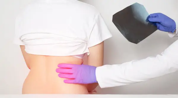 Médico examina radiografía mientras palpa la espalda de un paciente, buscando la causa del dolor en las costillas flotantes.