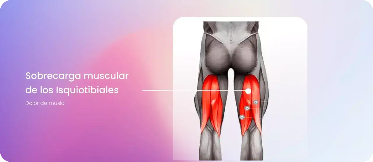 Anatomía de la pierna mostrando la sobrecarga muscular de los isquiotibiales, con los músculos resaltados en rojo.