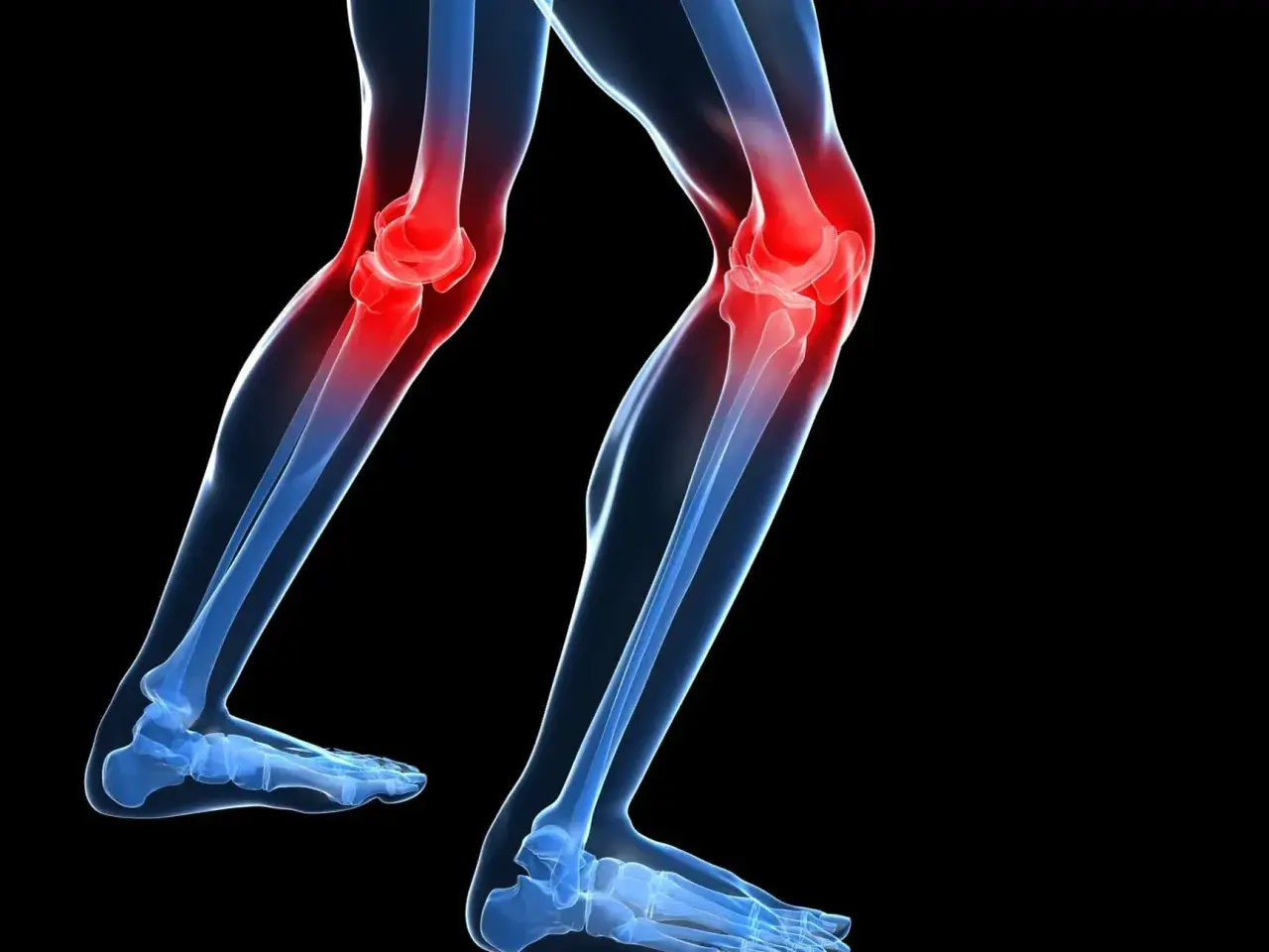 Ilustración de unas piernas con las rodillas en rojo, indicando dolor. De repente me falla la rodilla al caminar.