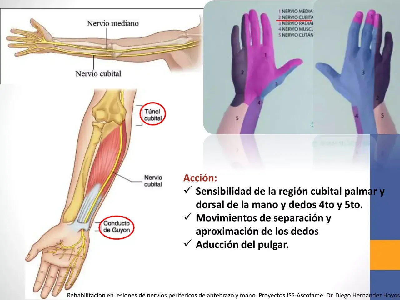Ilustración del brazo y mano mostrando el nervio cubital y su trayecto. El test nervio radial evalúa la sensibilidad y movimientos.