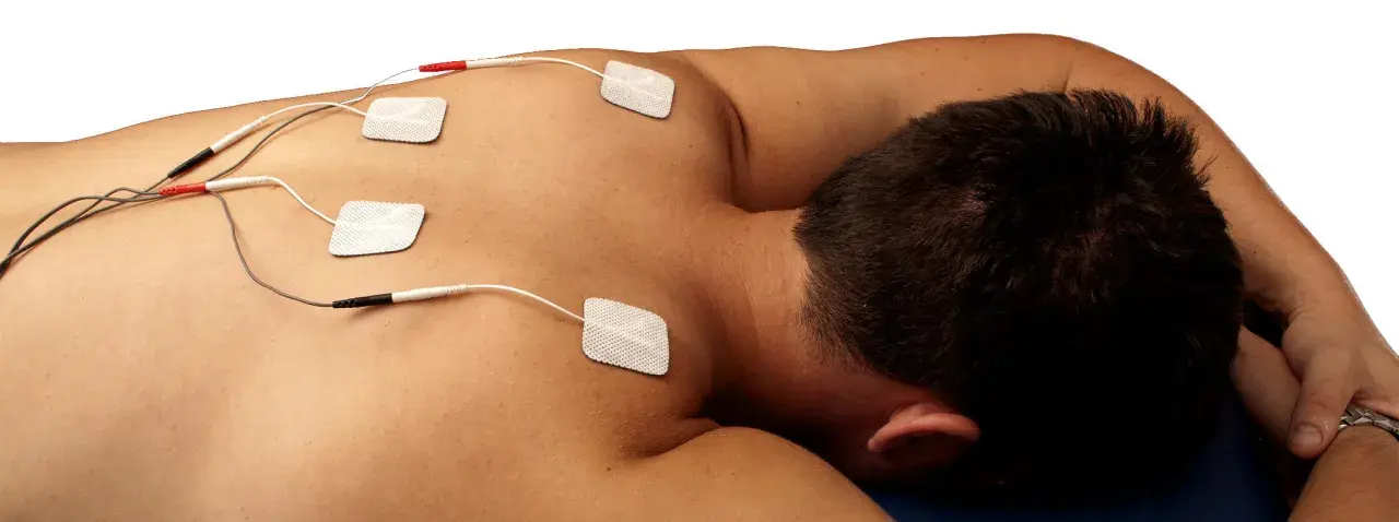 Electrodos colocados en la espalda de un hombre para tratamiento de electroterapia en fisioterapia.