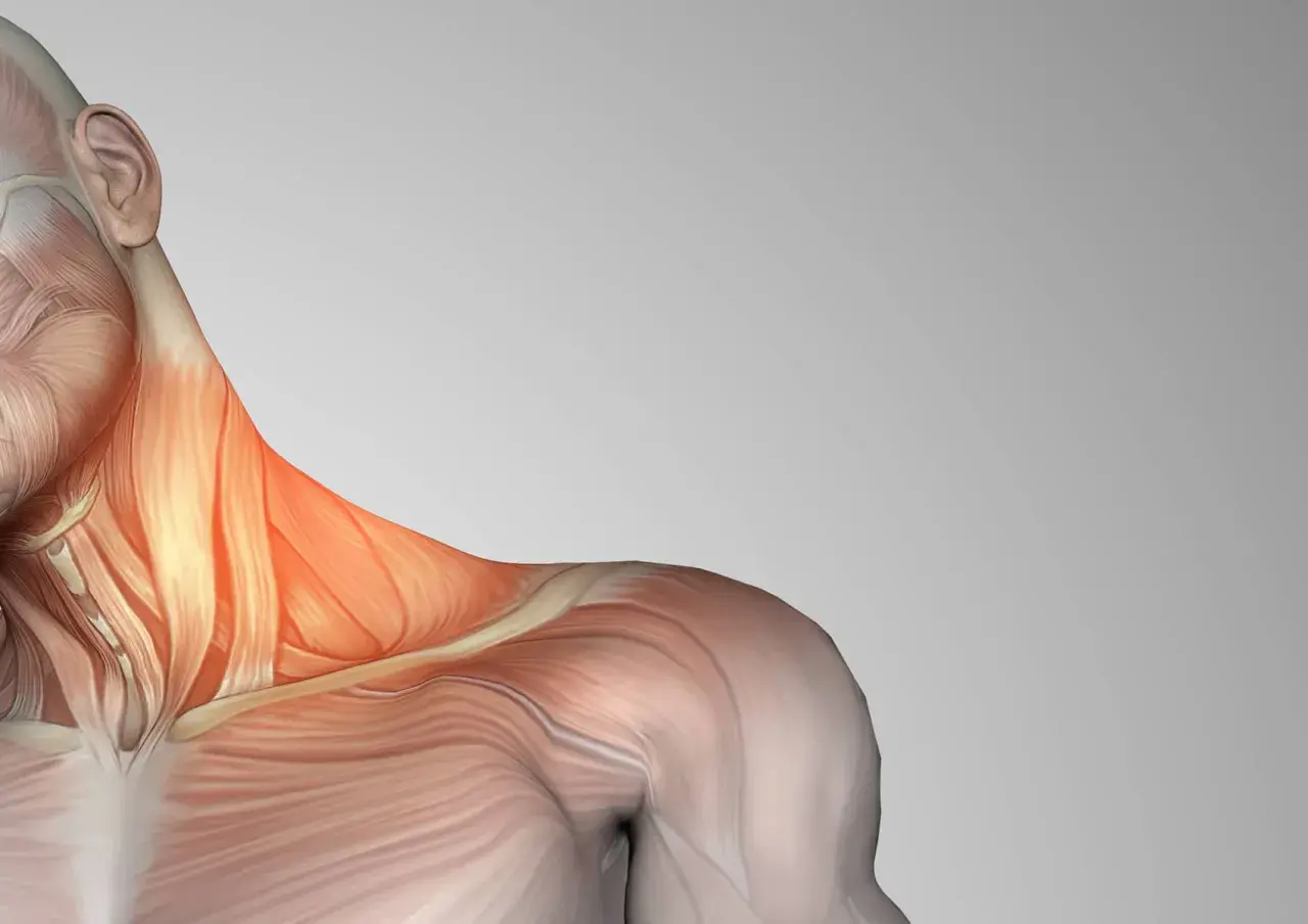 Anatomía del cuello con los escalenos musculos resaltados en rojo, indicando posible tensión o dolor.