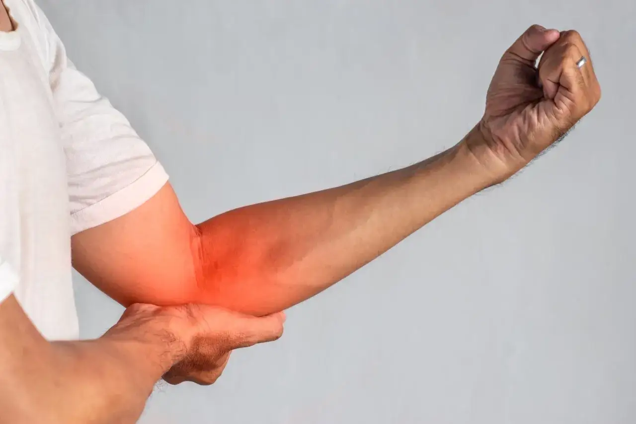 Brazo con zona enrojecida en el codo, indicando posible irritaci&oacute;n o dolor, quiz&aacute;s relacionado con neurodinamia cubital.