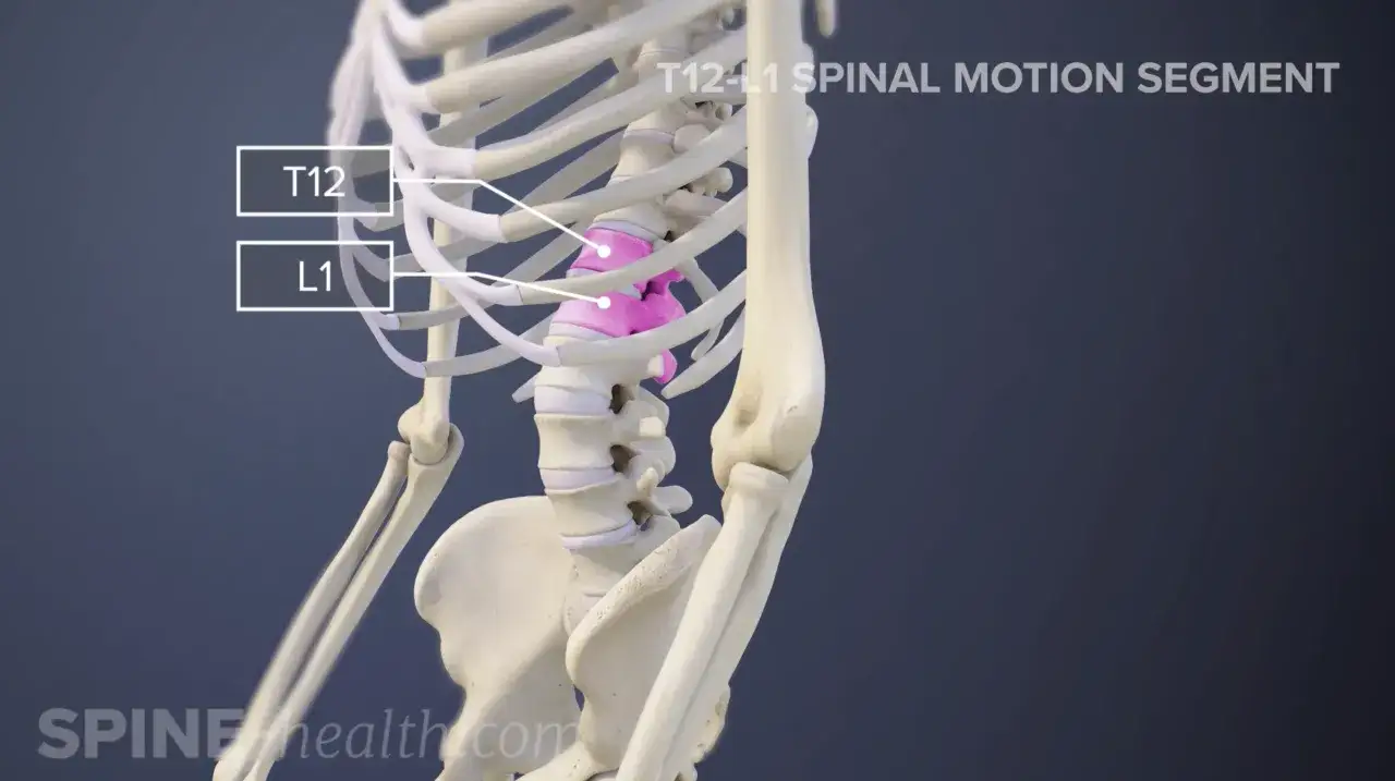 Segmento de movimiento espinal T12-L1, destacando la charnela dorsolumbar con discos intervertebrales en rosa.