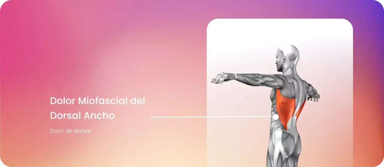 Anatomía muscular que muestra el dolor dorsal ancho y su ubicación.