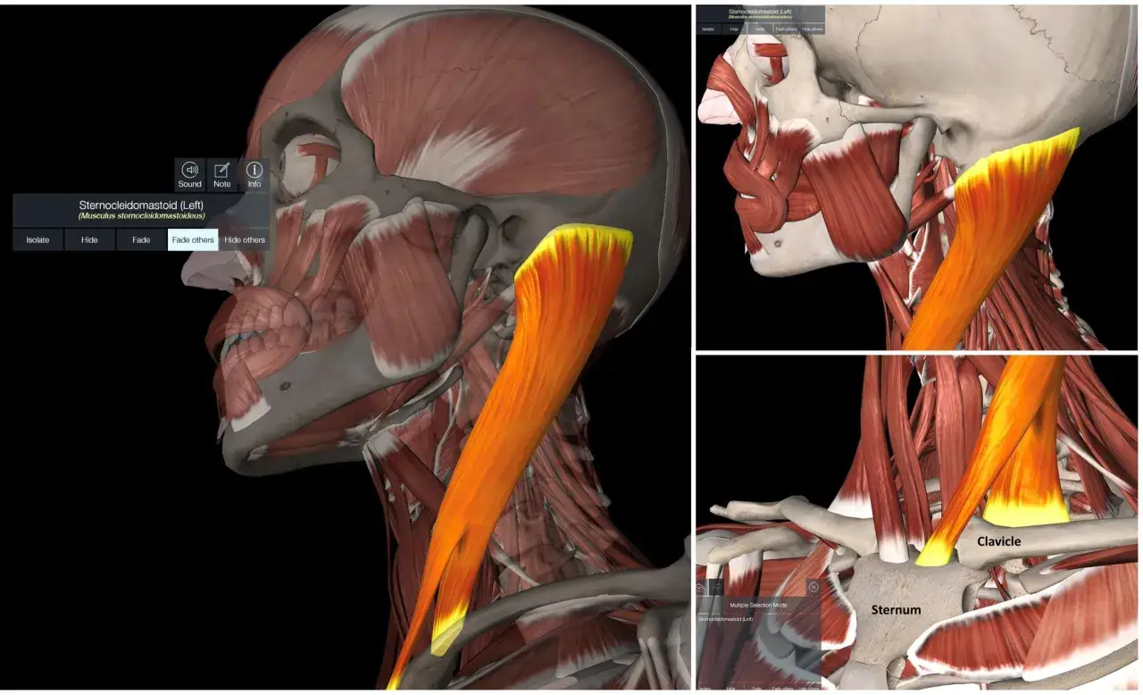 El músculo esternocleidomastoideo se extiende desde el esternón y la clavícula hasta el cráneo.
