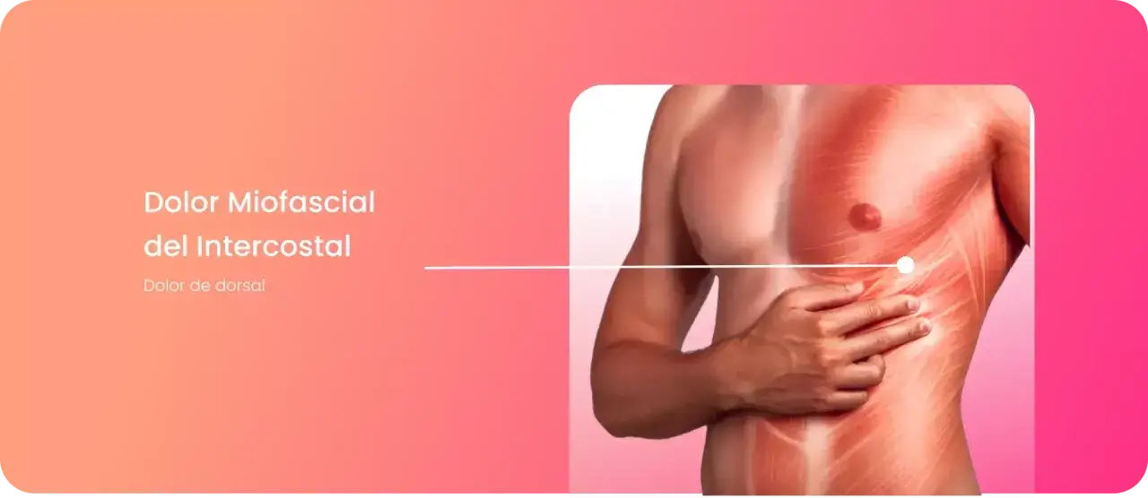 Anatom&iacute;a de un hombre con dolor miofascial intercostal, se&ntilde;alando el &aacute;rea de la costilla flotante derecha.