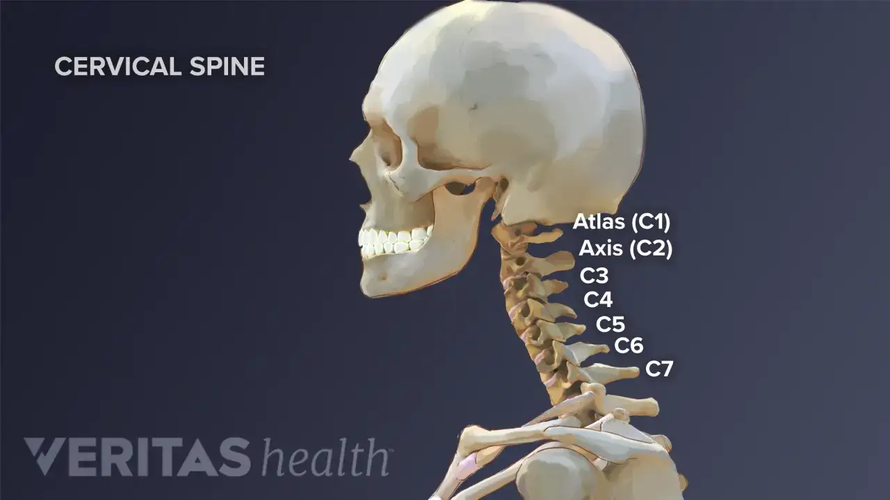 Esqueleto humano mostrando la columna cervical, con etiquetas para Atlas (C1), Axis (C2) y C3-C7. Una fractura cervical puede afectar estas vértebras.