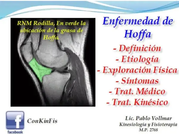 RM de rodilla que muestra la grasa de Hoffa en verde. Enfermedad de Hoffa: definición, etiología, exploración, síntomas y tratamiento.